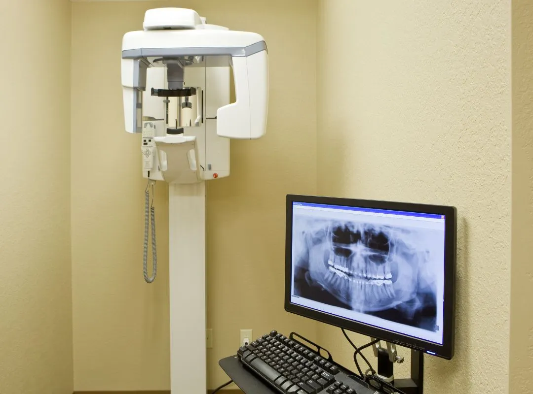 digital dental x rays machine
