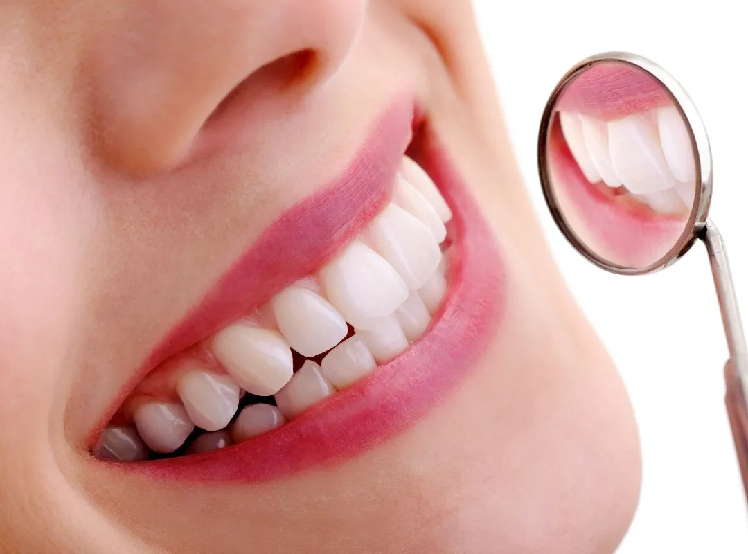 fluoride treatment (1)