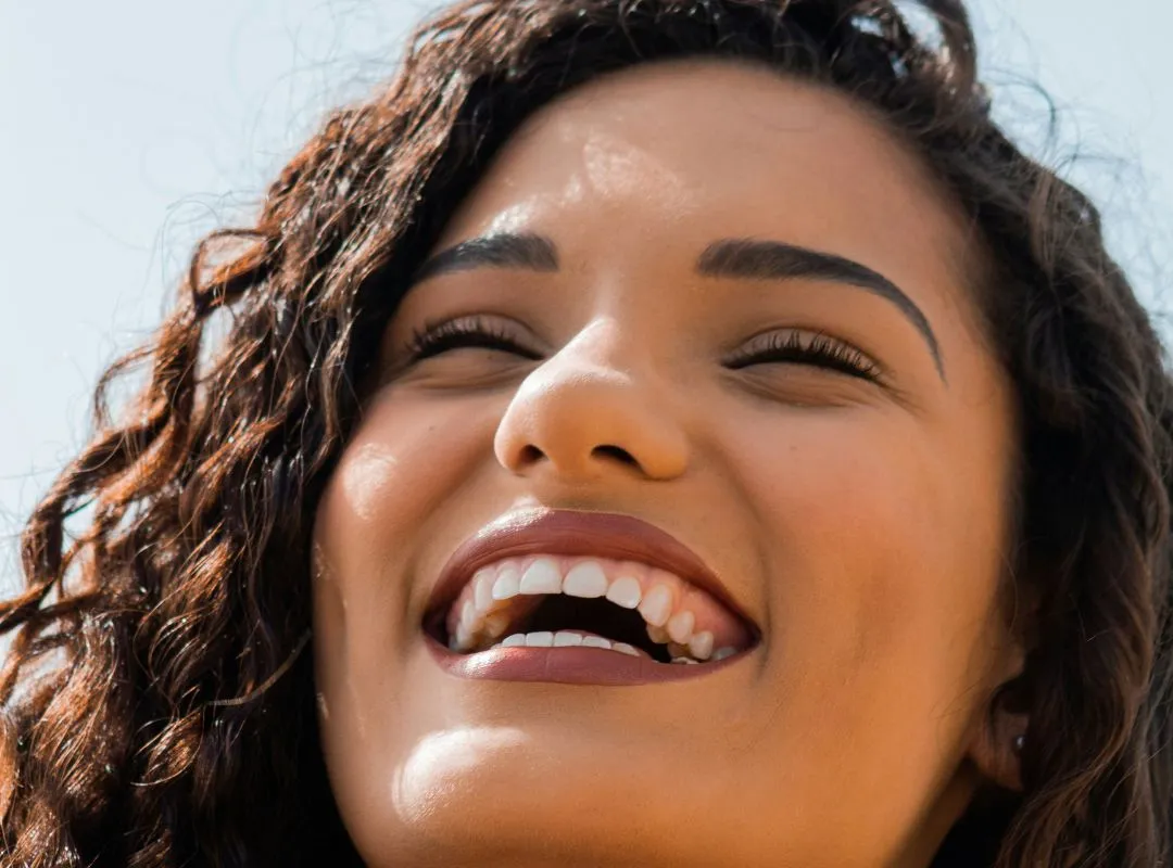 smile makeover