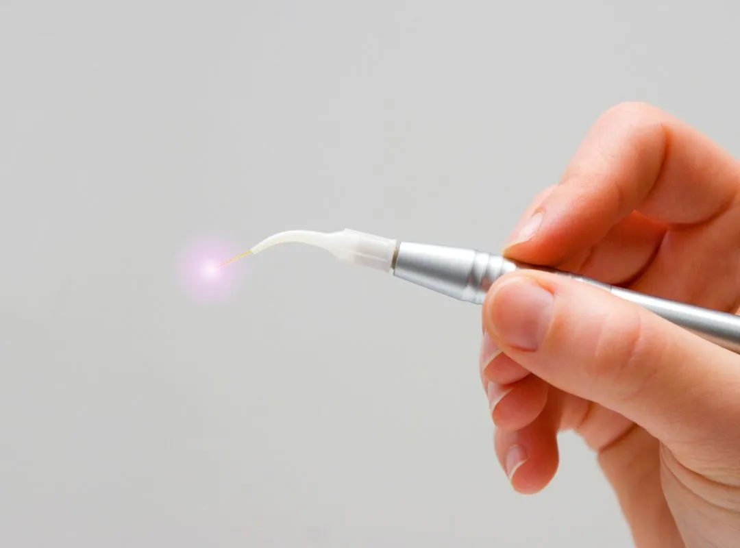 soft tissue lasers dental machine