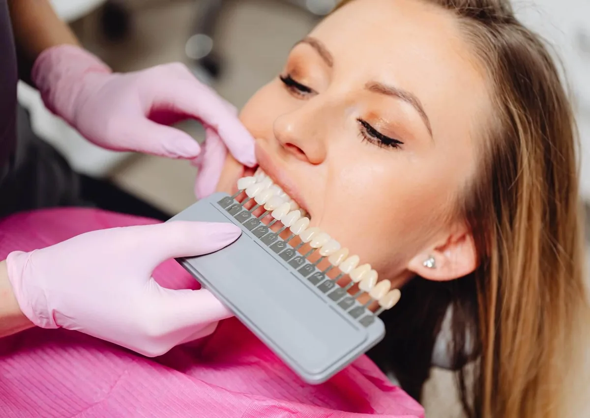 Dental professional using a tooth shade guide to match the color of a patient's front teeth when planning crowns or veneers.